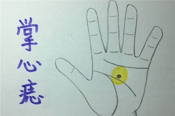 男孩左手掌心有痣