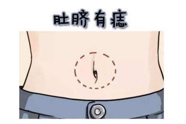 肚脐上长痣意味着什么